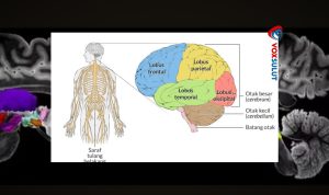 Bagian Otak yang Bisa Picu Koma dan Penjelasannya