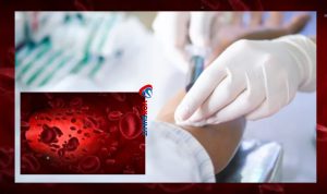 Teknologi Fashdu Metode Pengobatan Alternatif Mirip Donor Darah Teknologi Fashdu Metode Pengobatan Alternatif Mirip Donor Darah