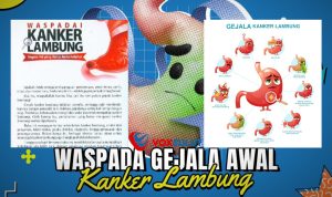 Waspadai Kanker Lambung Gejala, Penyebab, dan Solusi Waspadai Kanker Lambung Gejala, Penyebab, dan Solusi