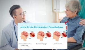 Waspadai Penyebab Stroke dan Cara Mencegahnya Sejak Dini Waspadai Penyebab Stroke dan Cara Mencegahnya Sejak Dini
