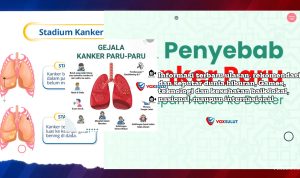 Gejala dan Faktor Risiko Utama Kanker Paru yang Perlu Diwaspadai