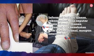 Tanda Penyakit Hati yang Terlihat di Tangan dan Kaki