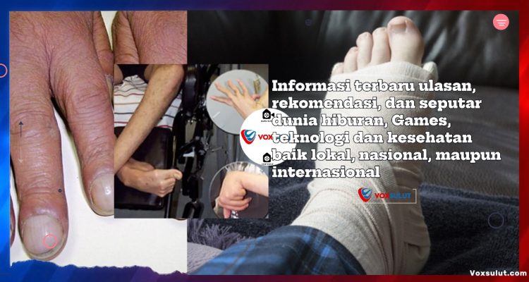 Tanda Penyakit Hati yang Terlihat di Tangan dan Kaki