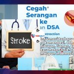 Cegah Stroke dengan Deteksi Dini DSA, Begini Penjelasannya