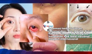 Mata Sering Berkedip, Benarkah Tanda Cacingan Mata Sering Berkedip, Benarkah Tanda Cacingan