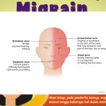 Migrain Gejala, Penyebab, dan Faktor Pemicu yang Perlu Diwaspadai