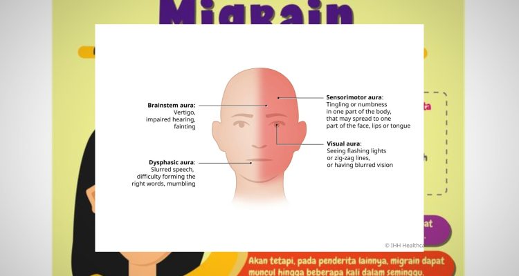 Migrain Gejala, Penyebab, dan Faktor Pemicu yang Perlu Diwaspadai