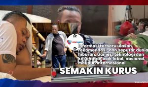 Sule Derita Tifus dan Anemia, Begini Kondisi Kesehatannya