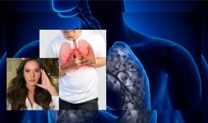 Waspadai Influenza A Penyebab, Gejala, dan Cara Mencegahnya