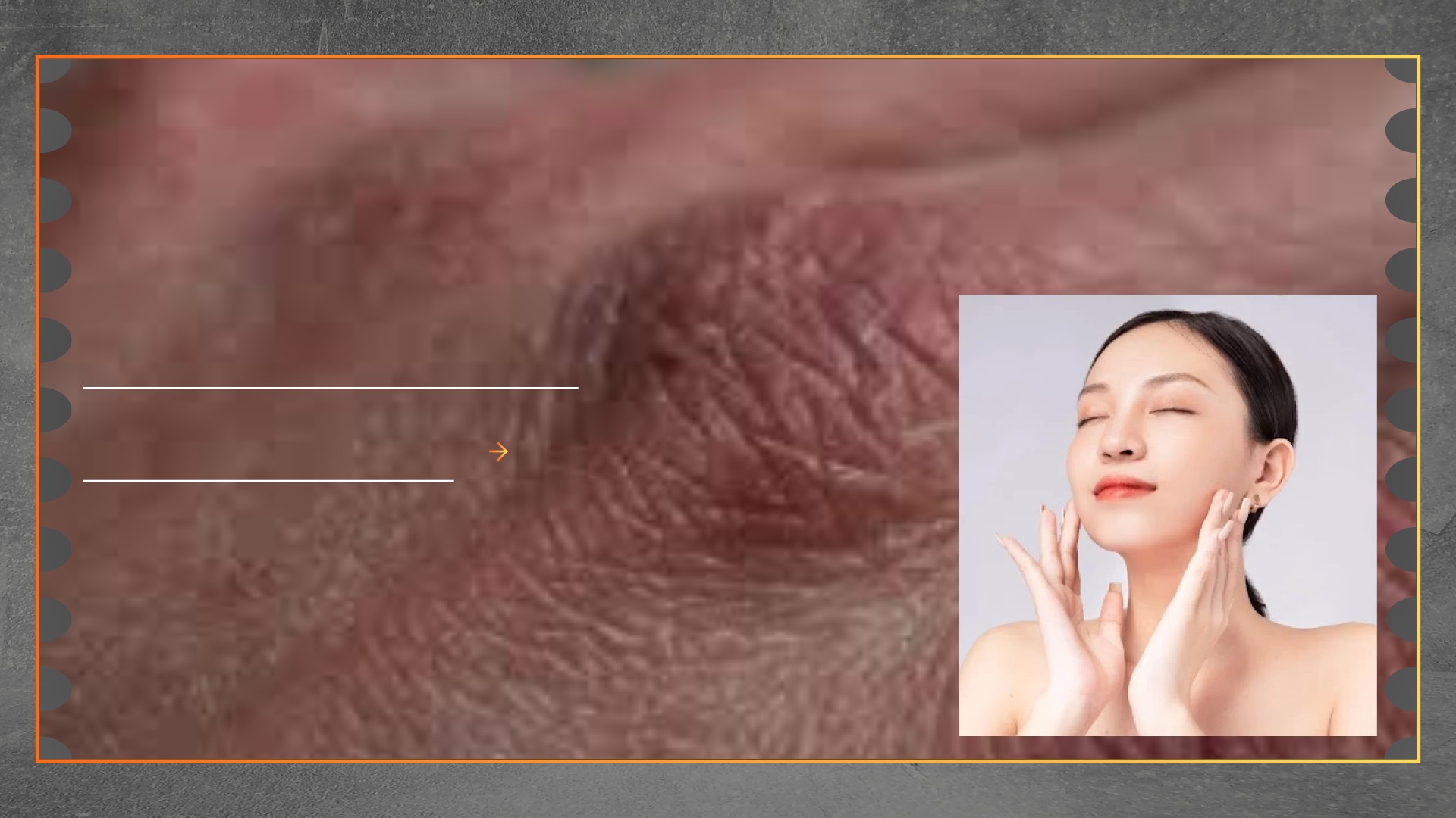 Kulit Kering Saat Puasa Ini Penyebab dan Solusinya