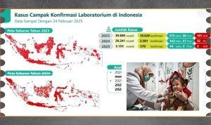 Lonjakan Kasus Campak Peran Data dan Teknologi Kesehatan