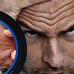 Kerutan Dahi Bisa Jadi Sinyal Risiko Penyakit Jantung
